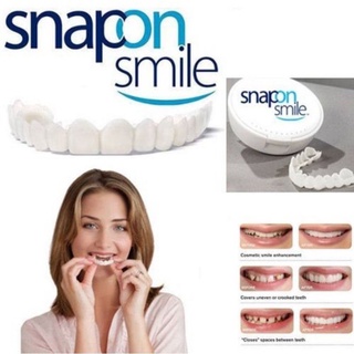 Snap on Dental Smile-Normal Quality